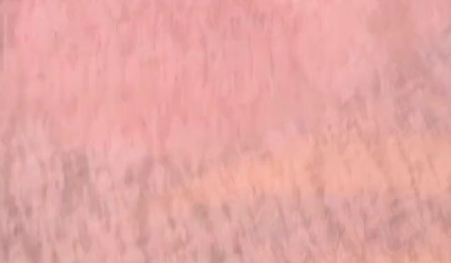 Thumbnail of Pissed in your jeans?