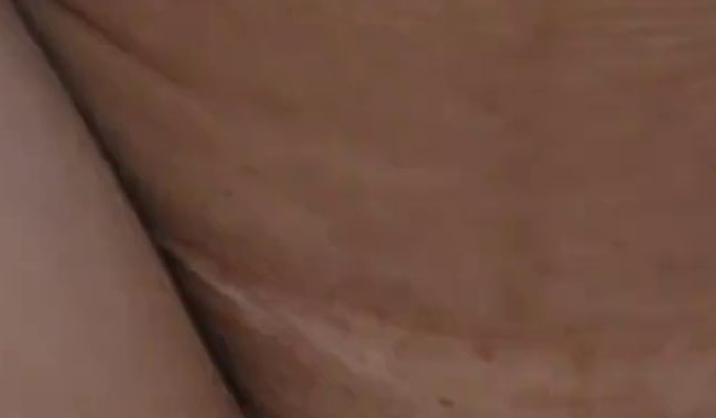 Thumbnail of Urgently pee